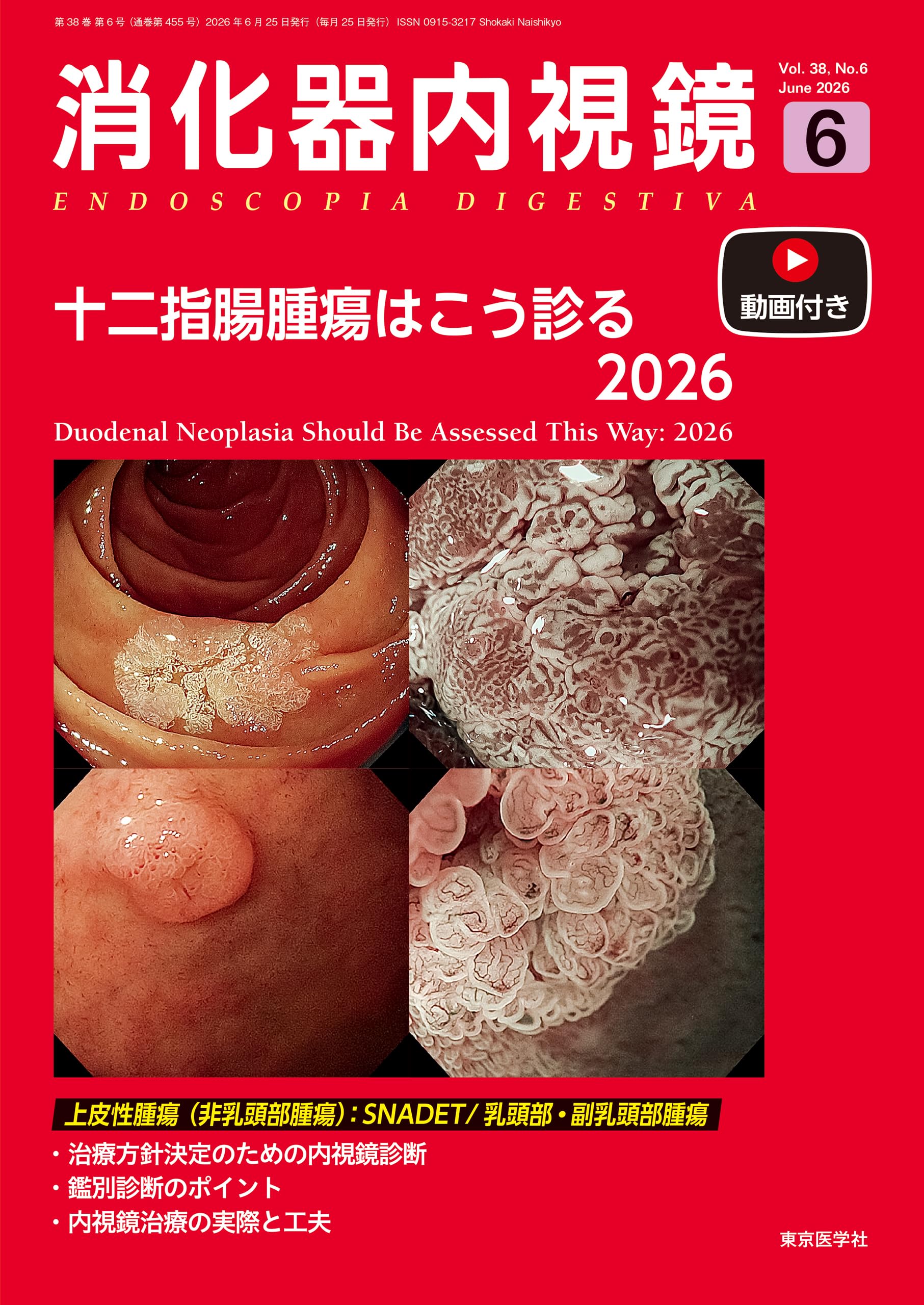 胃と腸 第38巻 2003年 12冊セット 消化器内視鏡38巻6号 2026年6月号 十二指腸腫瘍はこう診る2026